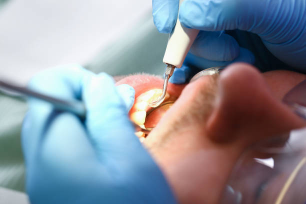 Best Emergency Treatment for Dental Infections or Abscesses in West St Paul, MN