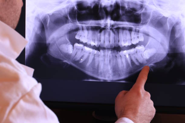 Best Emergency TMJ Treatment in West St Paul, MN