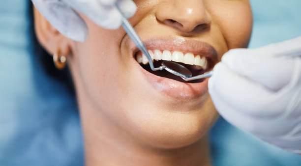 Best Urgent Care for Lost Fillings or Crowns in West St Paul, MN
