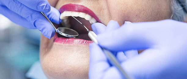 Best Emergency Denture Repair in West St Paul, MN